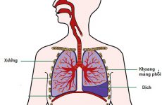 Tràn dịch màng phổi có nguy hiểm không