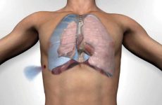 tràn khí màng phổi
